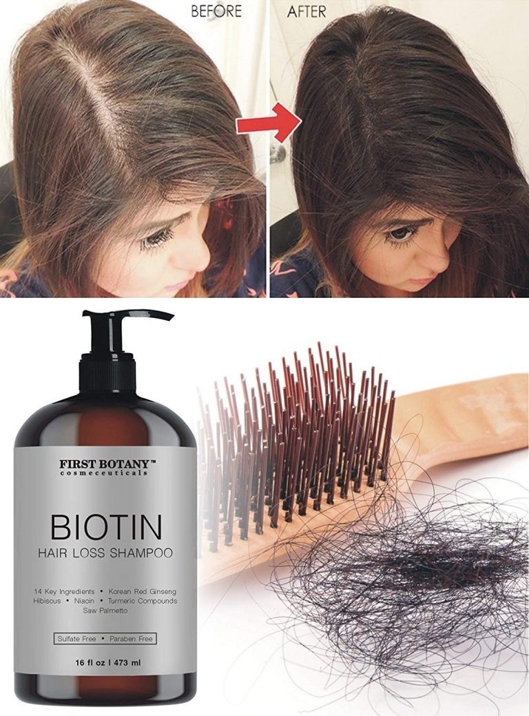 Champú para la regeneración del cabello y la caída del cabello, 16 fl ...